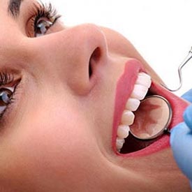 Dental Cleaning Service in Airdrie Dental Clinic