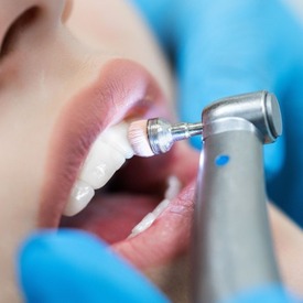 Dental Cleaning & Check-Ups