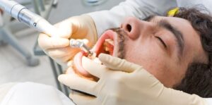 Regular Dental Cleanings in Airdrie