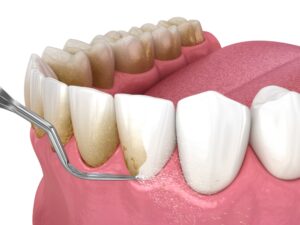 Periodontal Care for Your Overall Health